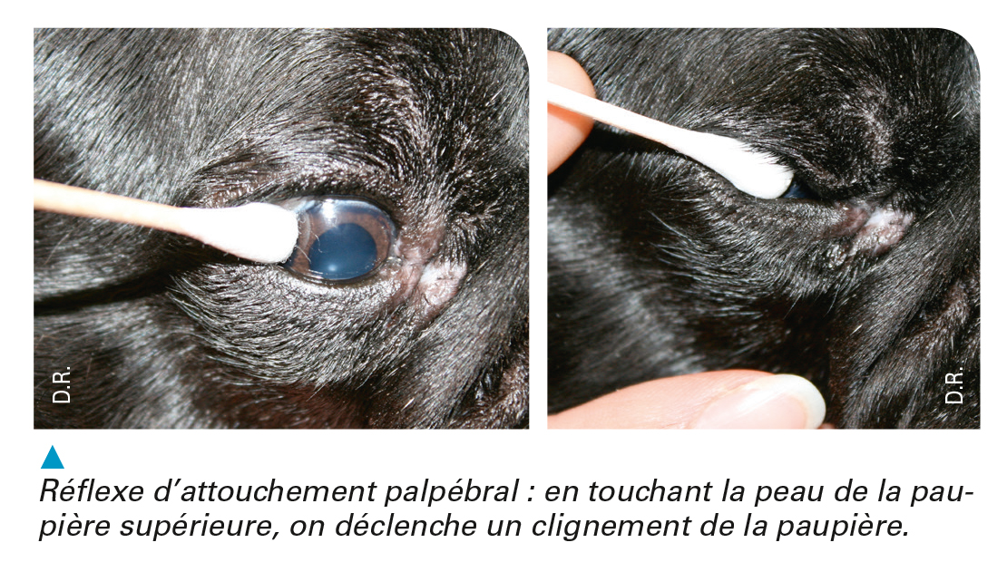 Neuro Ophtalmologie Rendre Simple Ce Qui Peut Paraitre Complique