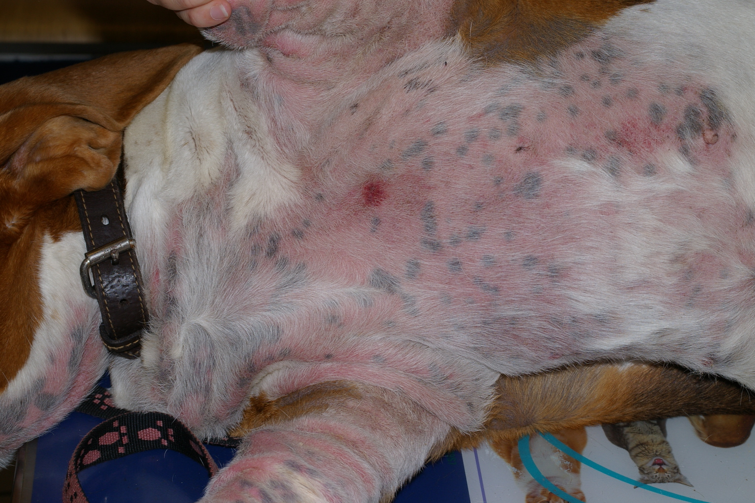 MOG et BOG : deux syndromes de prolifération microbienne