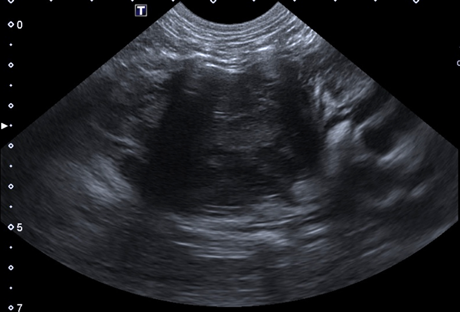 Dyspnee Et Abattement Chez Un Chat Europeen De Six Ans Quel Est Votre Diagnostic